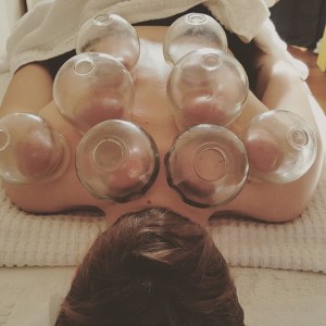 acupuncture Preston pain